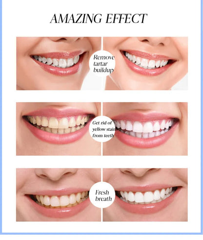 Lumora Teeth Whitening Serum Pen