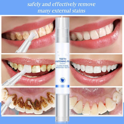 Lumora Teeth Whitening Serum Pen